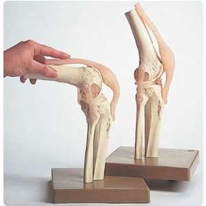  Functional Model of the Knee Joint