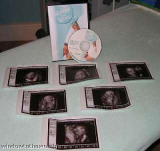 4D baby scan pictures 26 28 weeks items in WINDOW TO THE WOMB 4D BABY 