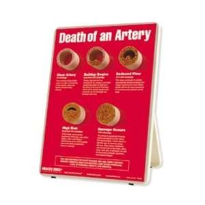  Death of an Artery Easel Display: Arts, Crafts & Sewing